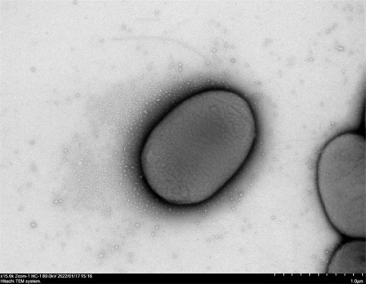 四川大学华西医院生物医学研究,四川大学华西医院感染科