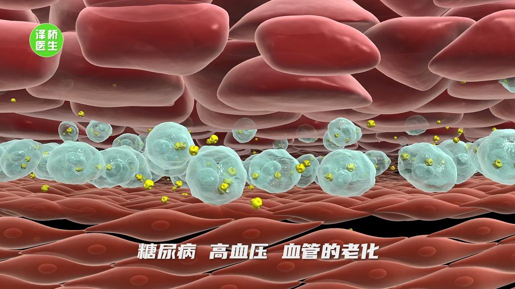 你以为的“累”，有可能是脑出血的前兆