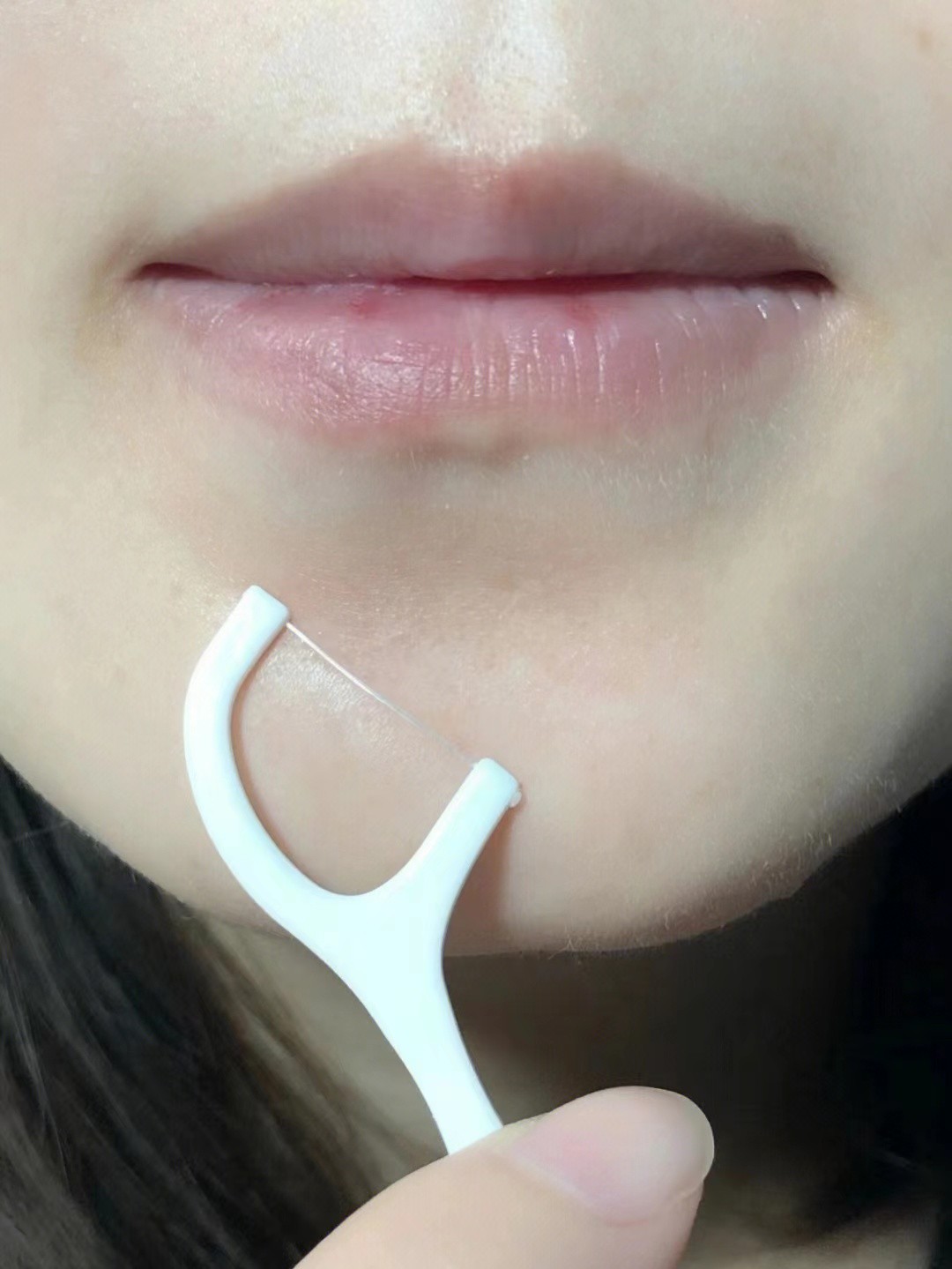 下巴总长痘痘抹什么药,下巴总长痘痘和闭口怎么办