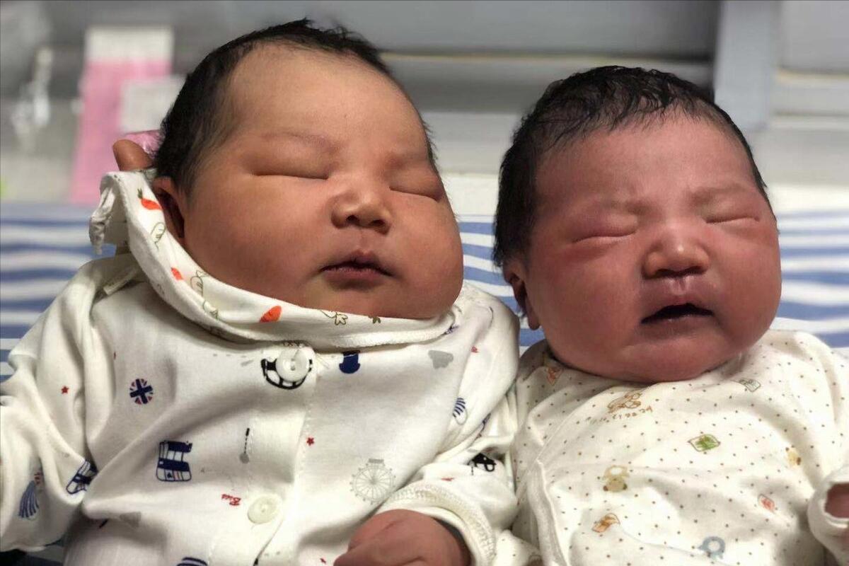 2-3岁语言发育迟缓家长评估表,如何辨别孩子处于生长发育期