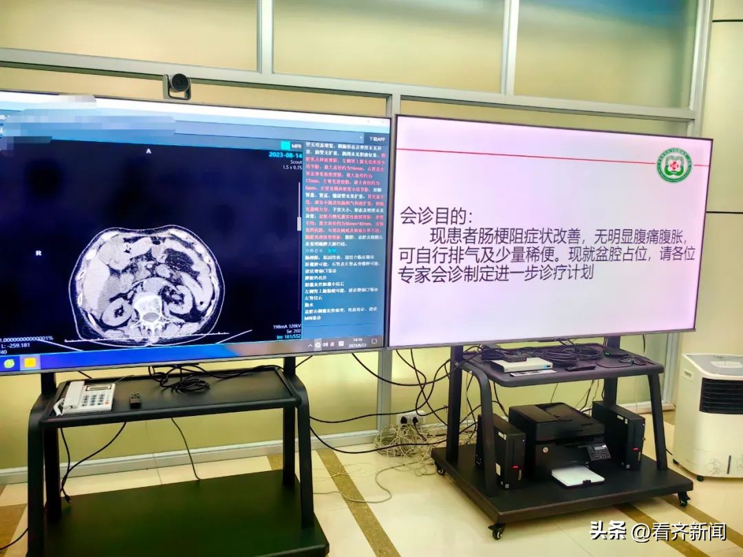 齐医附属三院MDT：打破学科壁垒！患者不动医生动