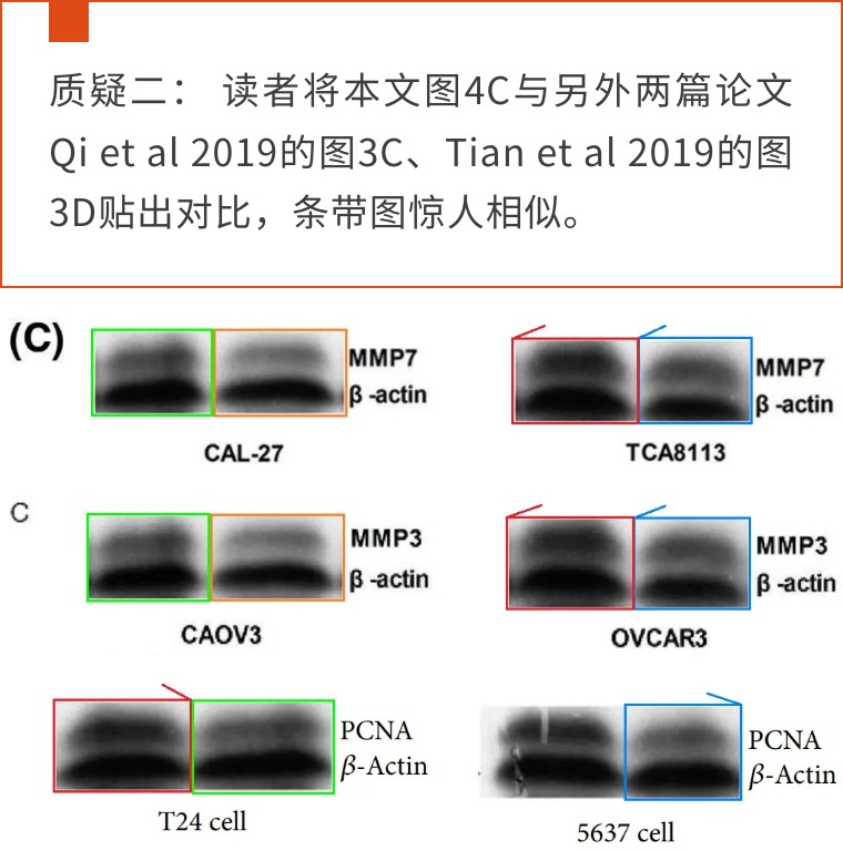 极大关注！天津医科大学第二医院发表的论文因明显图片重复被质疑