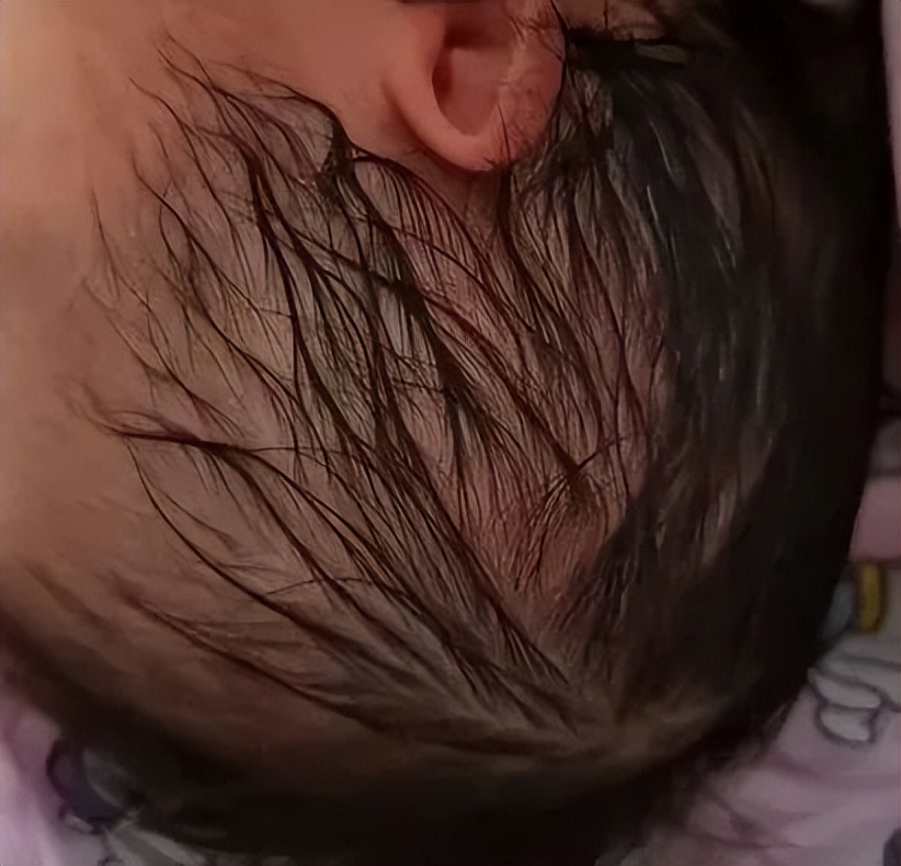 婆婆不开空调致孕妇中暑三分野,婆婆不开空调孕妇中暑后续