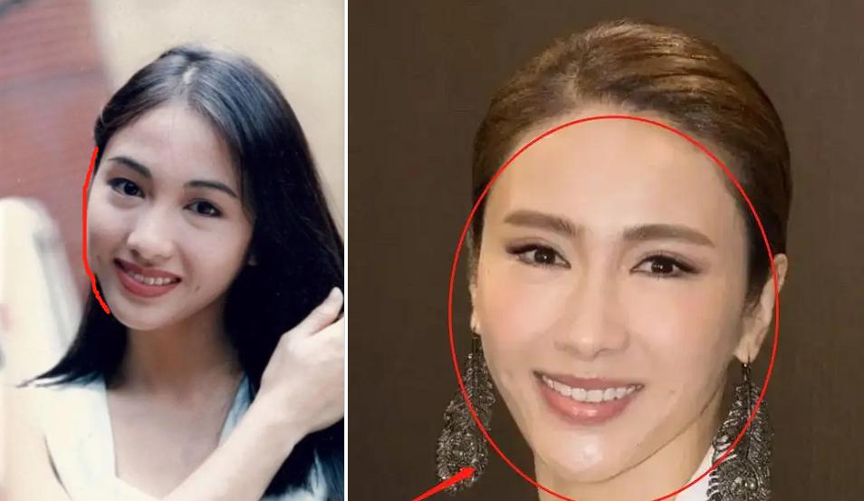 方脸和高颧骨怎么抗老,高颧骨好看还是低颧骨抗老