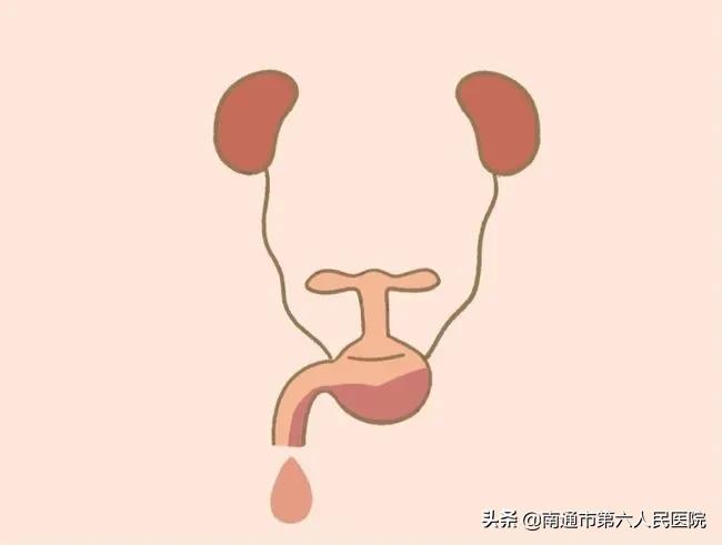 女性尿频尿不尽是肾有问题吗,女性尿频尿急尿不尽是为什么