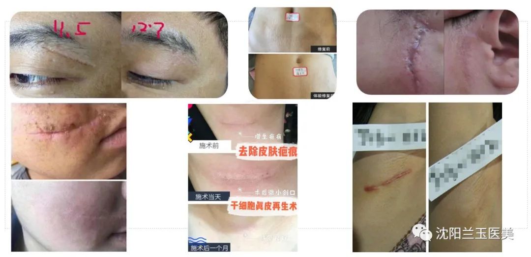 沈阳兰玉医美怎么样,盘锦兰玉医美