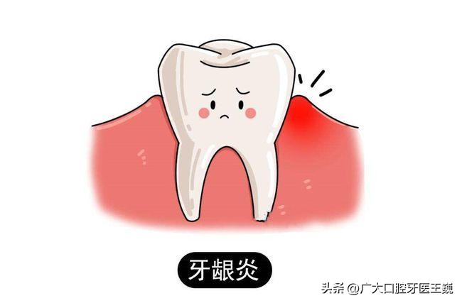 牙龈出血是什么原因牙龈大量出血,牙龈出血的原因和治疗方法是什么