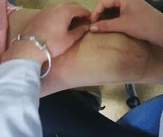 膝关节疼痛或外伤，做完手术在床上静养三个月就可以活动如初了？