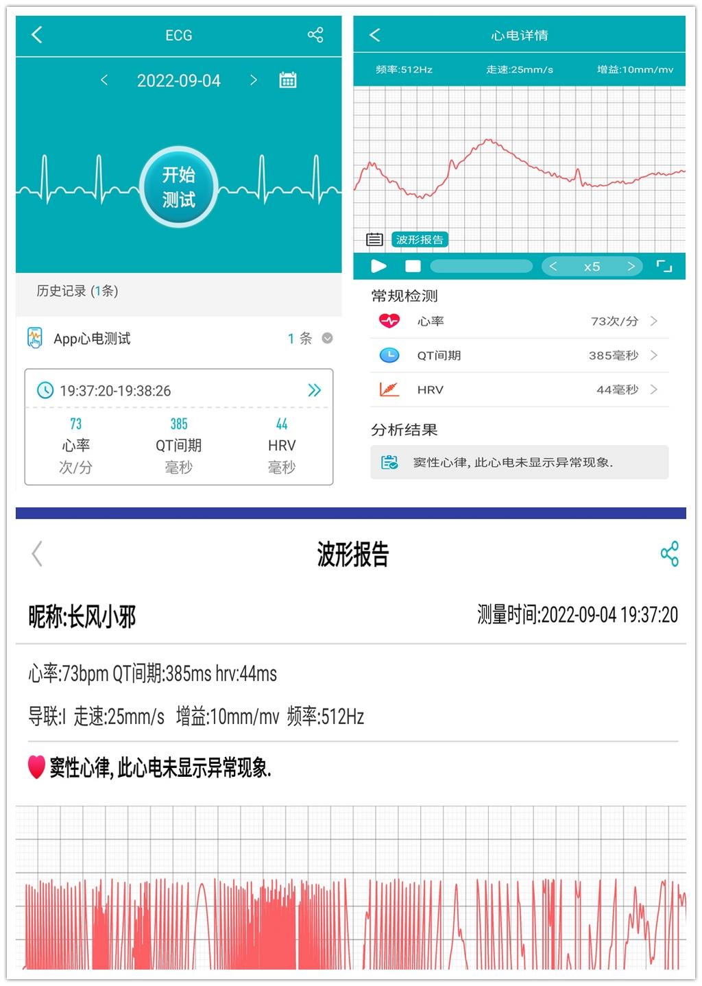 dido智能手表g28三个版本的区别,dido智能手表g28