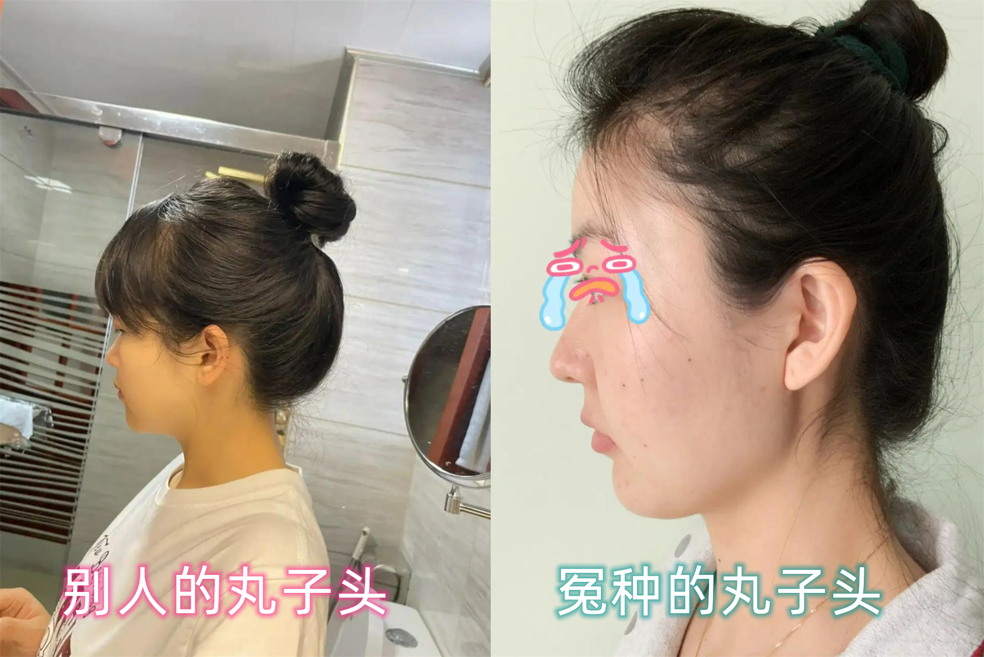 娱乐圈扁头发型,娱乐圈的扁头盘点