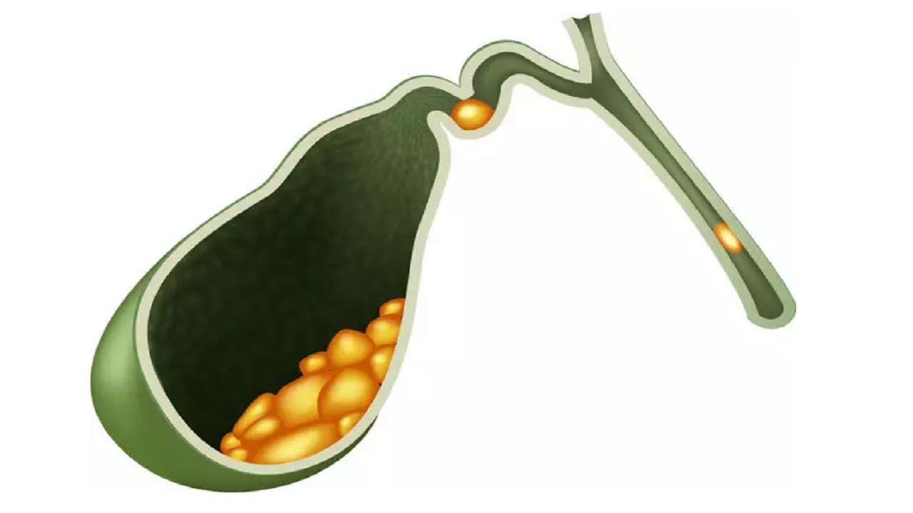 护肝片养生谣言,长期吃护肝片对身体有什么影响