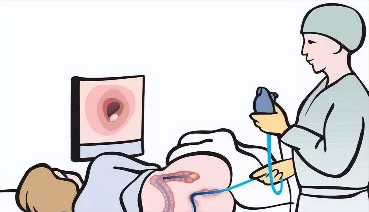 男医生做肠镜会难为情不,做肠镜是男医生还是女医生做的