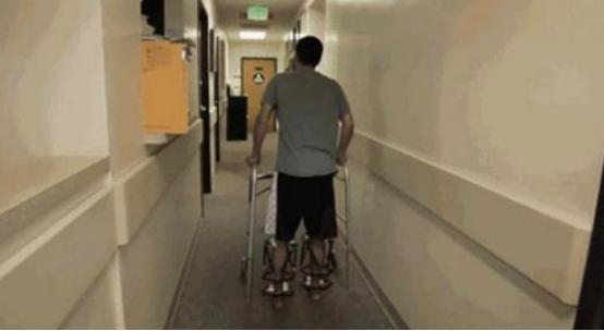 李亚诺断骨手术,断骨增高7.2厘米的李亚诺现状