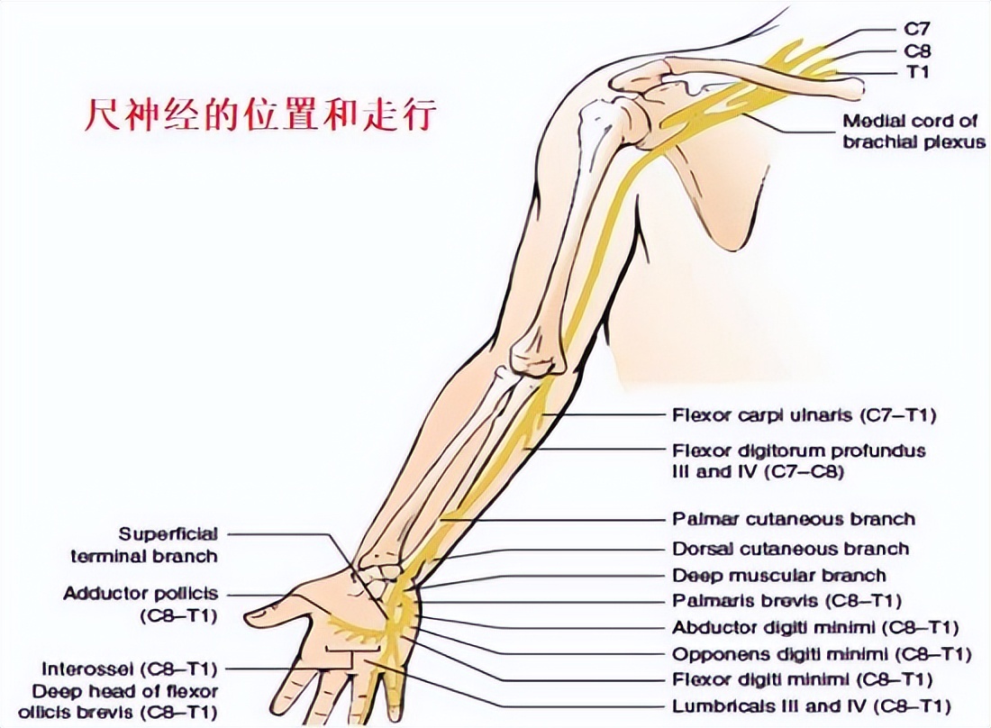 手部麻木怎么办,手部麻木吃什么药好