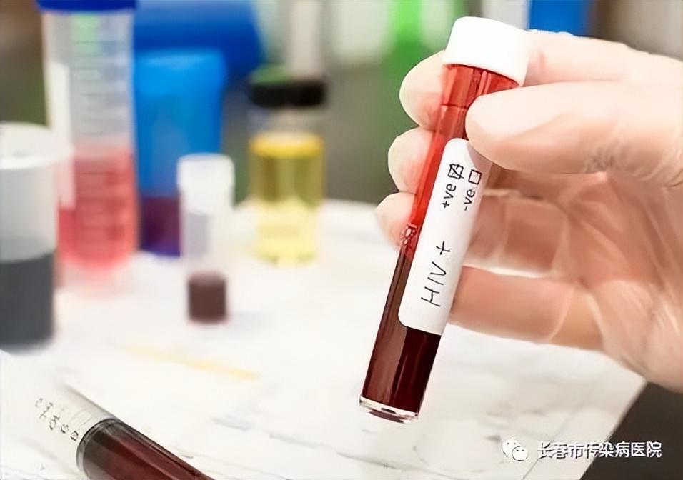 12.1艾滋病宣传日,12月1日艾滋病日新闻