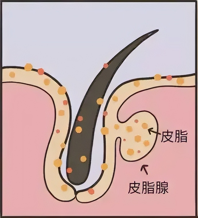 洗完澡身上痒还起皮是怎么回事,洗完澡皮肤干燥起皮浑身痒