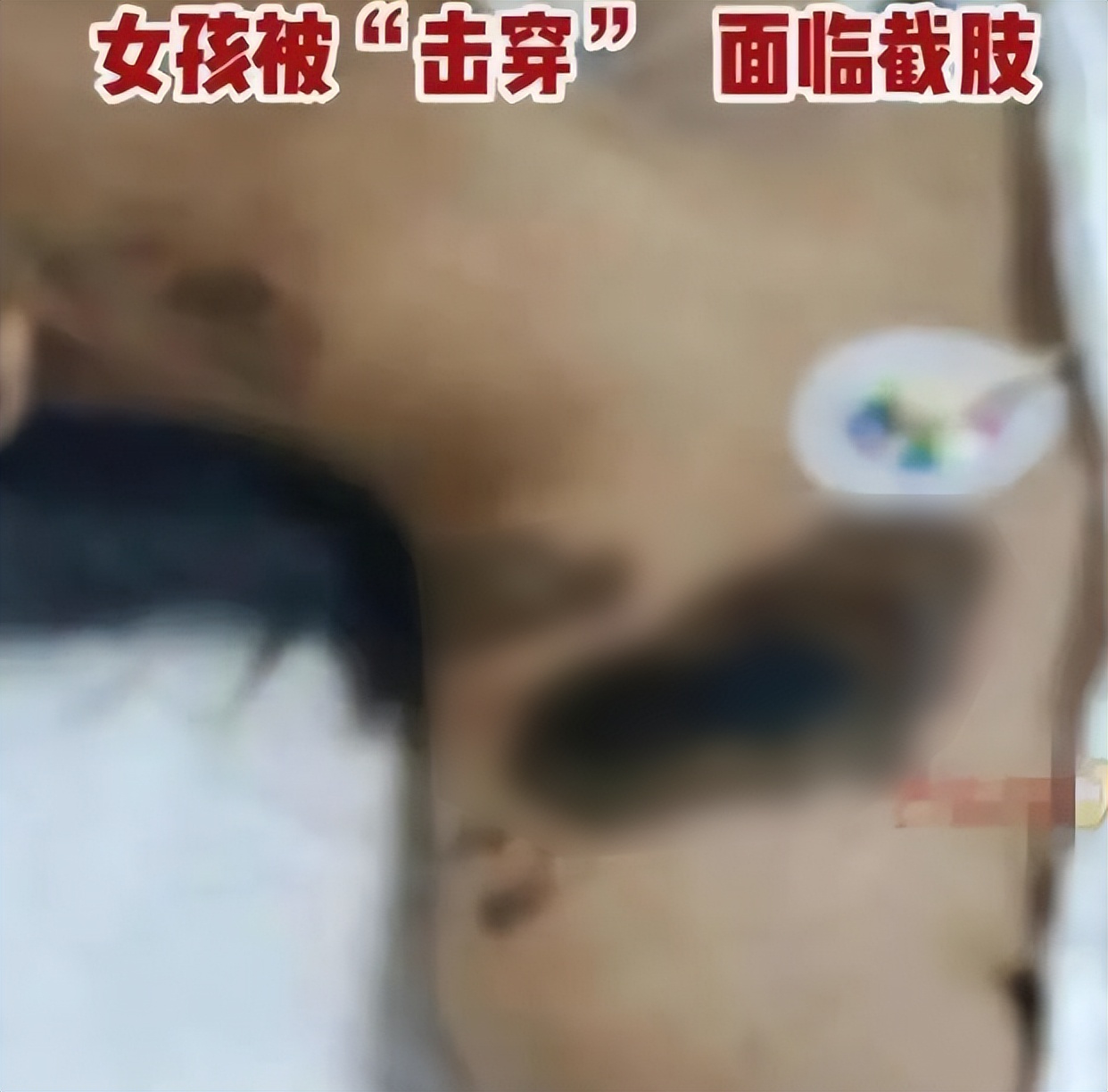 苹果回应女孩充电玩手机被电击,女孩充电时玩手机被电击苹果后续