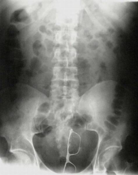 79个难得一见照片，飞机释放烟雾弹，逃票的女乘客，飞翔的蝙蝠