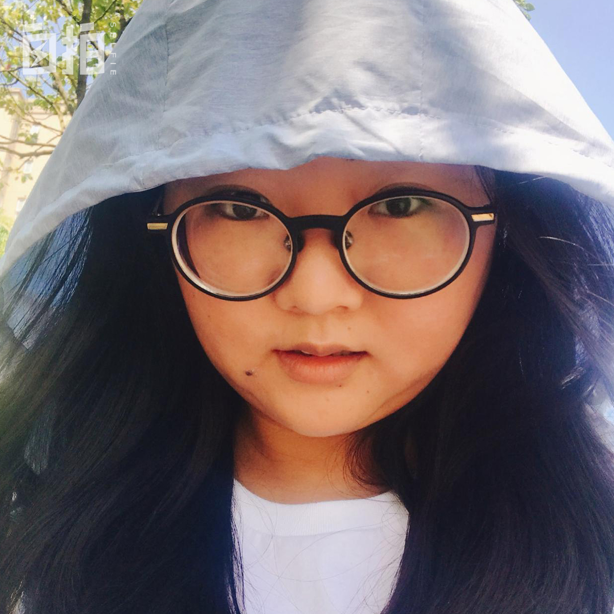 我，小城女孩，29岁失聪，为恢复听力，靠自己一年半攒30万手术费