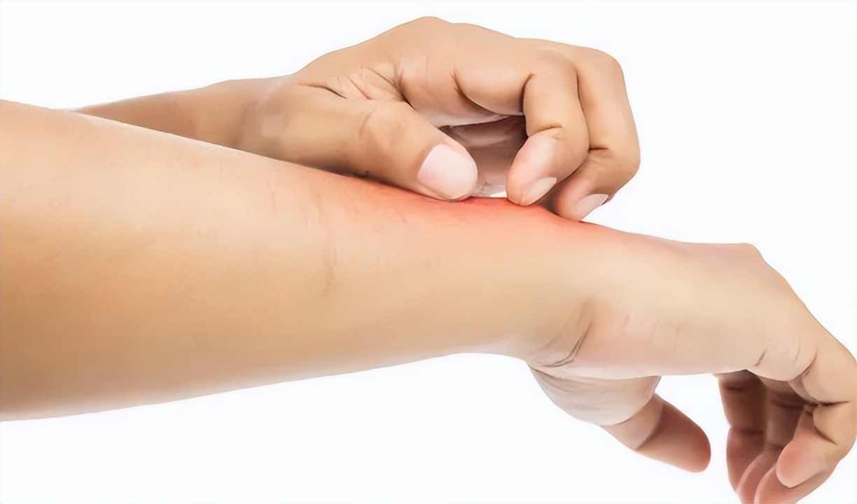 桃红四物汤治皮肤痒,当归饮子治皮肤瘙痒怎么用