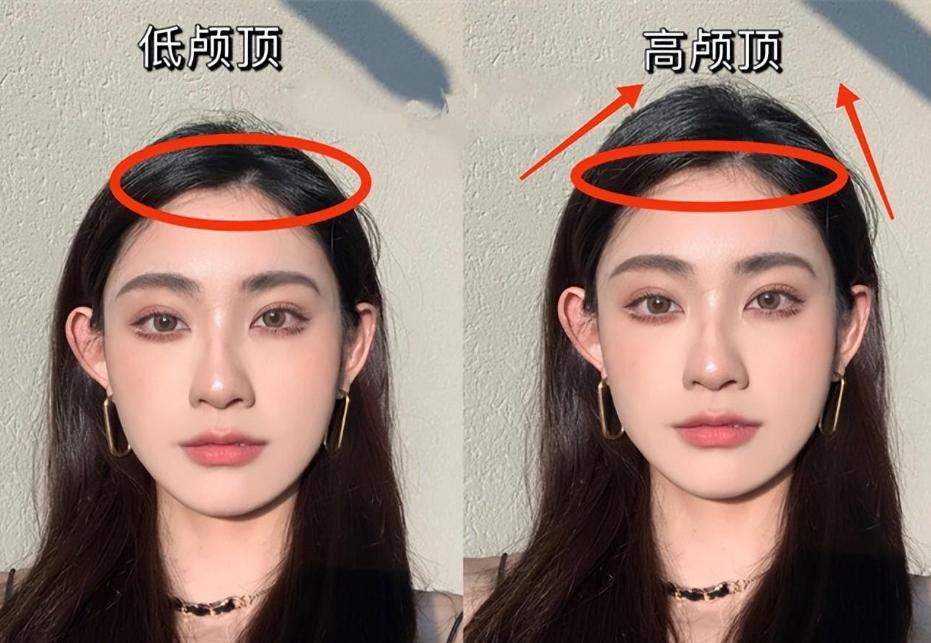 年纪大了为什么头发稀疏了,随着年龄增长头发变稀疏正常吗