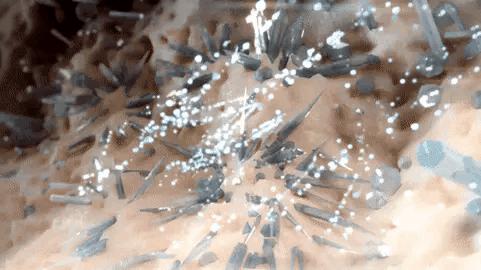 怎样才能确定是痛风性关节炎,关节疼如何区分是痛风还是风湿