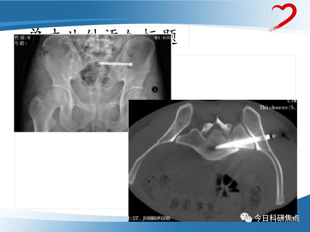 资源共享|创伤骨科PPT大放送！快来一起学习吧