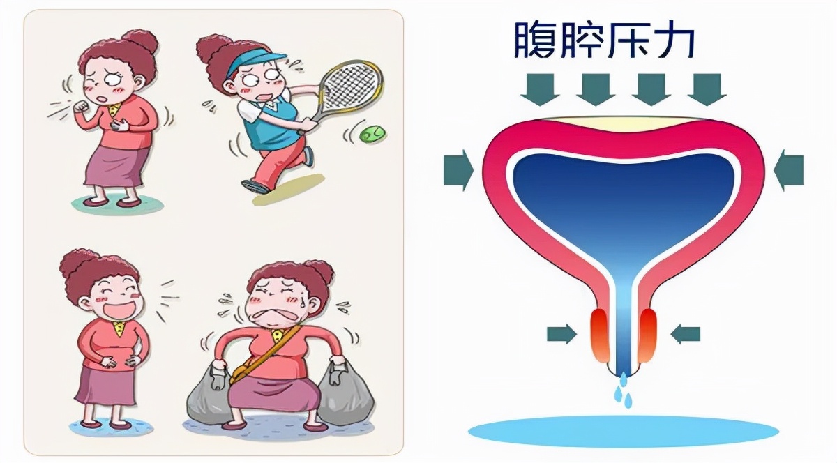 一天接了3个急诊，都是黄体破裂，黄体到底是什么？女性该知道