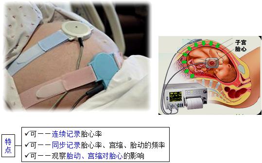 孕妈妈需要经历什么,从怀孕到生需要做多少次产检