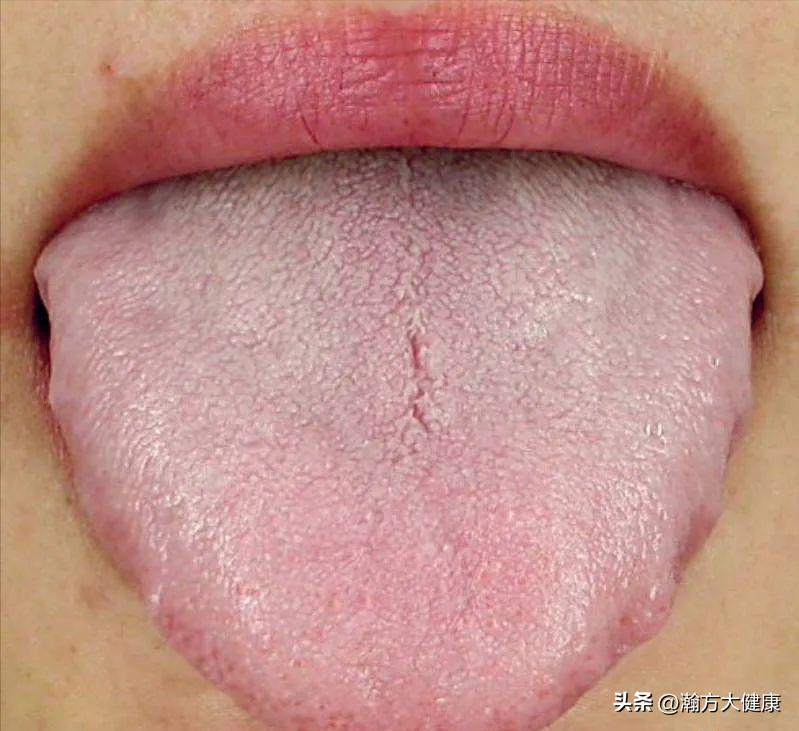 气虚是什么样的症状,气虚的症状表现有哪些该如何补