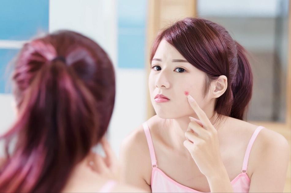 痘痘长在不同位置的原因,脸上三角位置长痘痘为什么不能挤