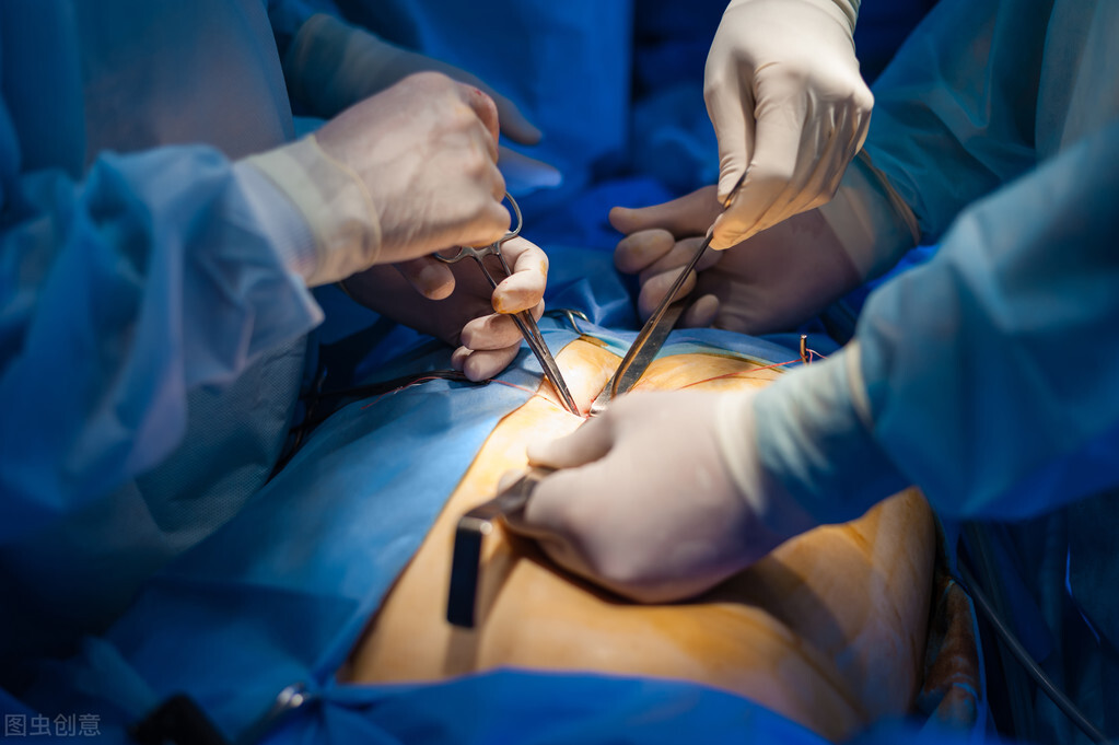 胆囊壁增厚可以自己恢复正常吗,意外发现胆囊癌