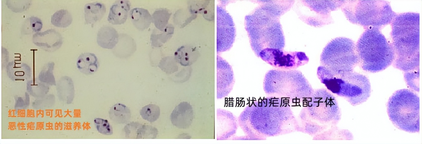 哪些寄生虫的感染阶段是虫卵,什么情况下会感染寄生虫