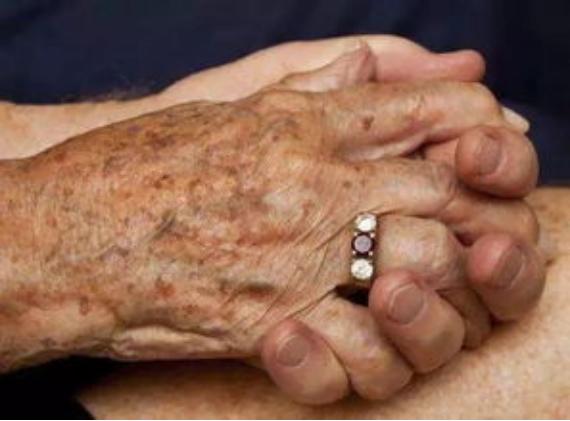 脂溢性角化老年斑会不会自动愈合,脂溢性角化老年斑用什么药膏