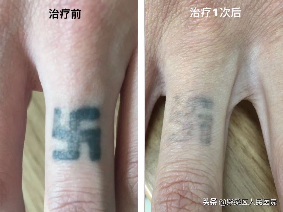 【医疗惠民】柴桑区人民医院3.8女神节优惠活动又来啦！