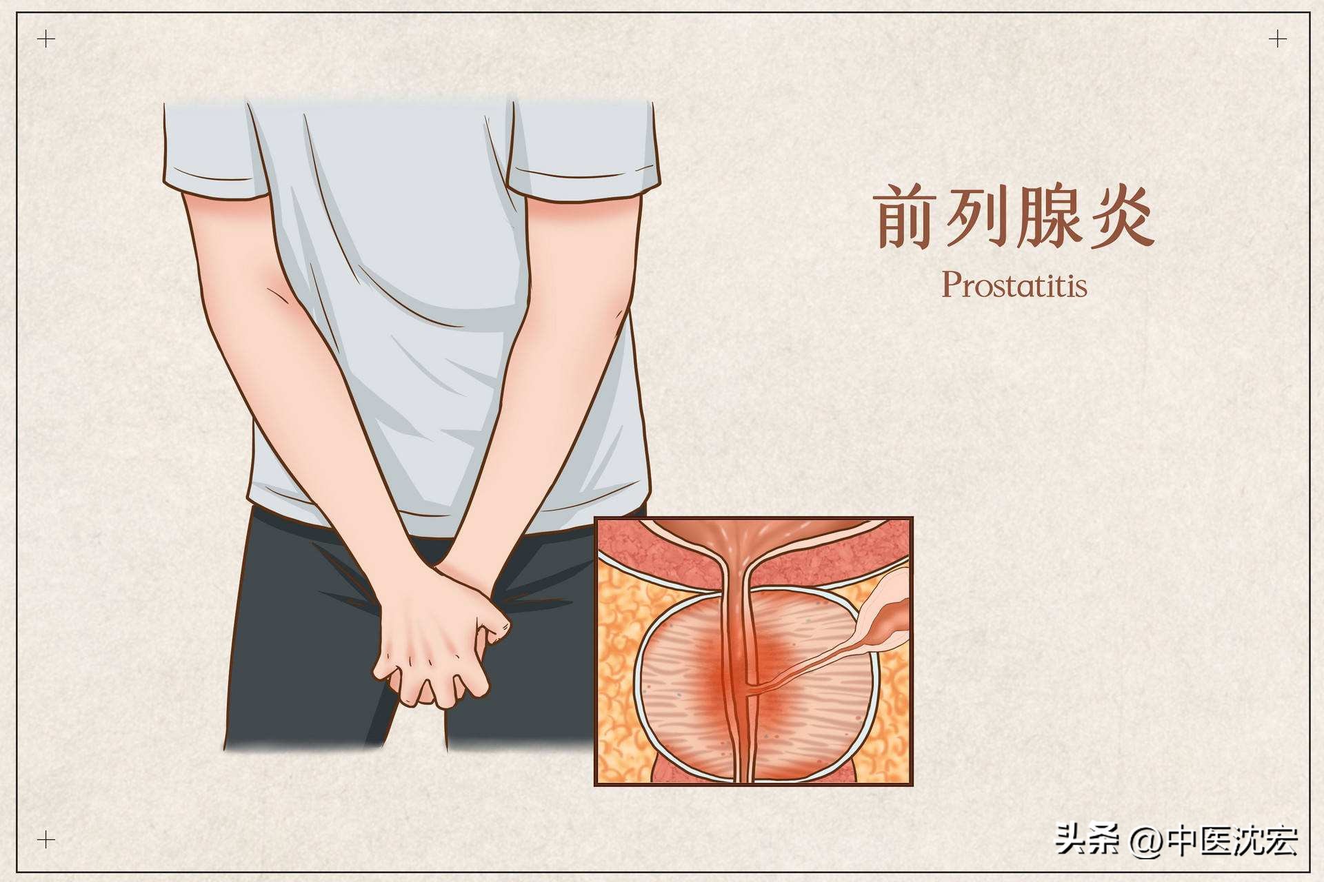 金匮肾气丸加什么药补肾效果好,金匮肾气丸治疗什么效果最好