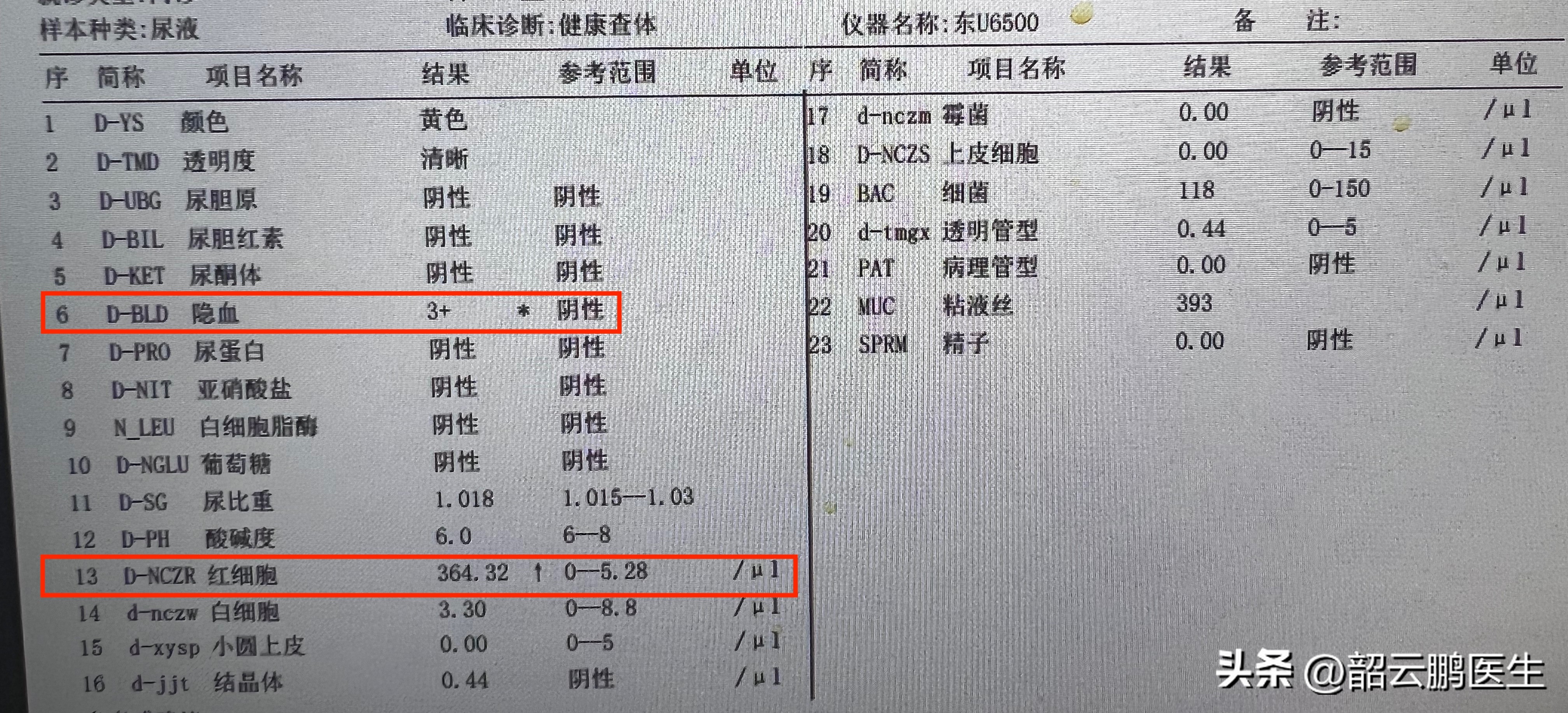 尿液有隐血可以抗凝吗,小便有血去医院检查有没有事