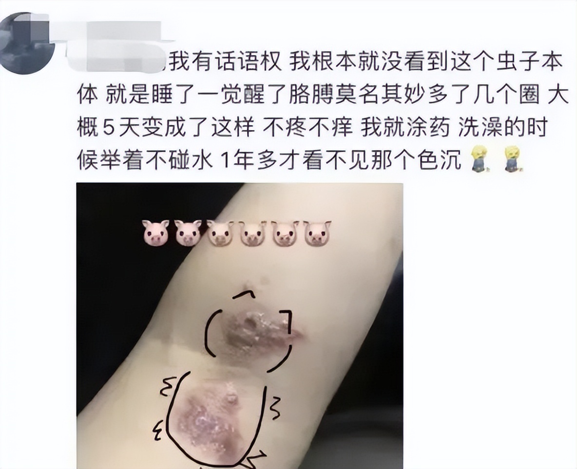 千万不要用手拍的几种虫子,碰到这些虫子千万不要去碰