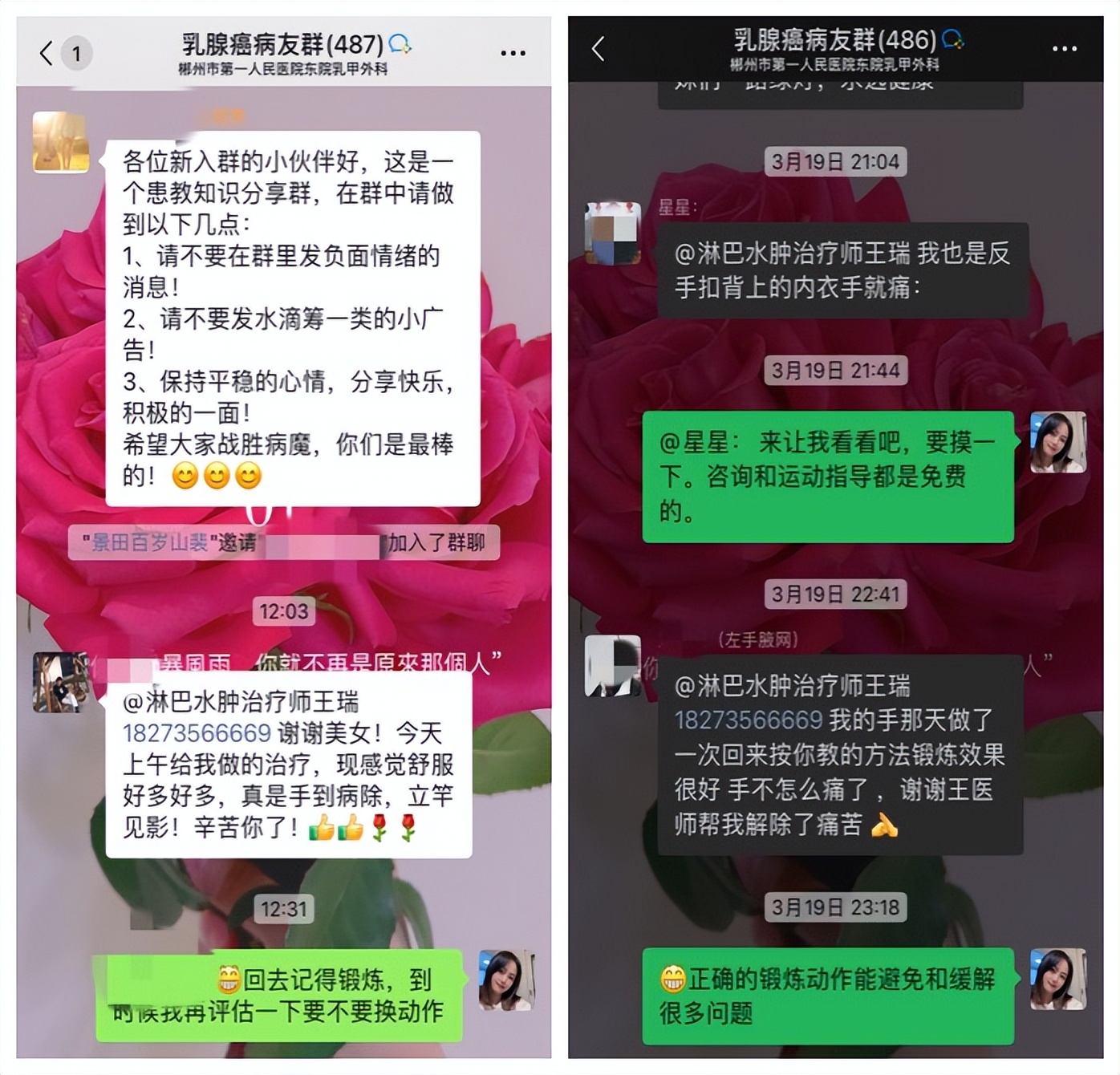 淋巴水肿外阴肿怎样锻炼,淋巴水肿引起腿肿怎么治