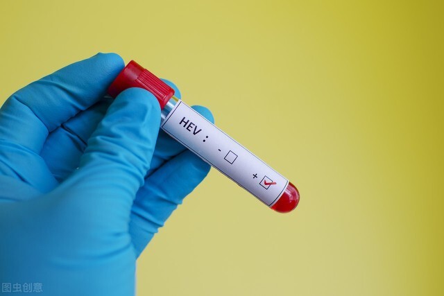 男子吃了一盘家常菜竟多器官衰竭,男子每天228颗维生素吃出肝衰竭