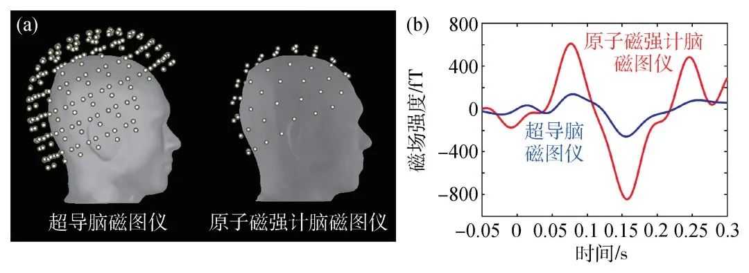 新型原子磁强计：脑磁测量技术的创新与突破丨贝研报02