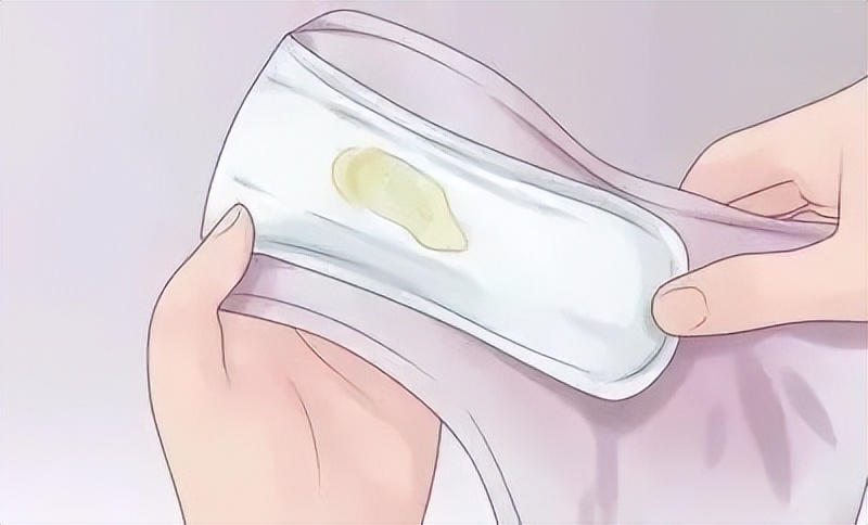 女生底裤发黄发硬怎么回事,女性裤头发黄是什么原因