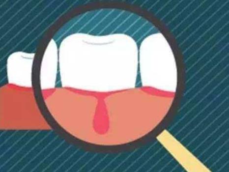 电动牙刷注意事项这三类人要慎用,电动牙刷安全问题大全