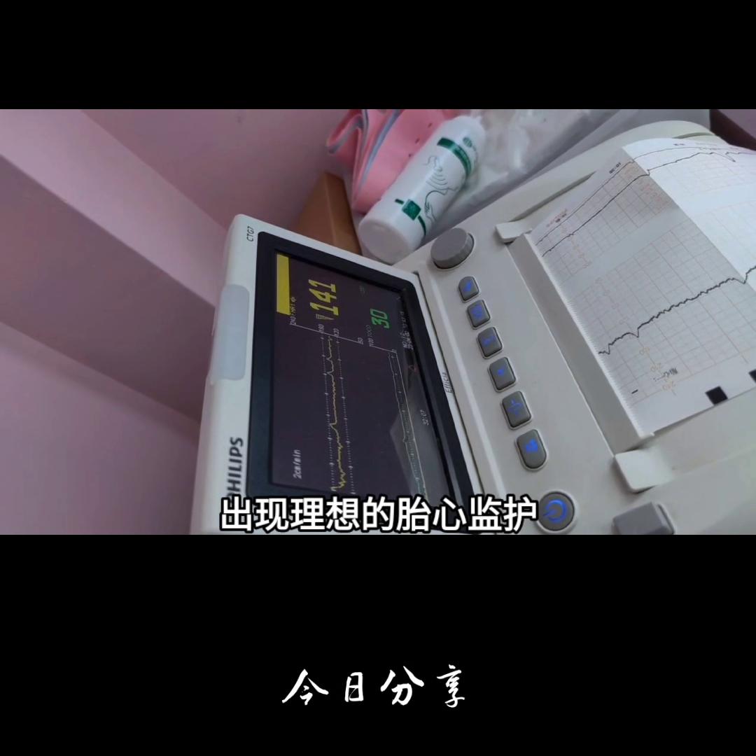 胎心监护不过关是不是需要再付费,胎心监护不过160正常吗