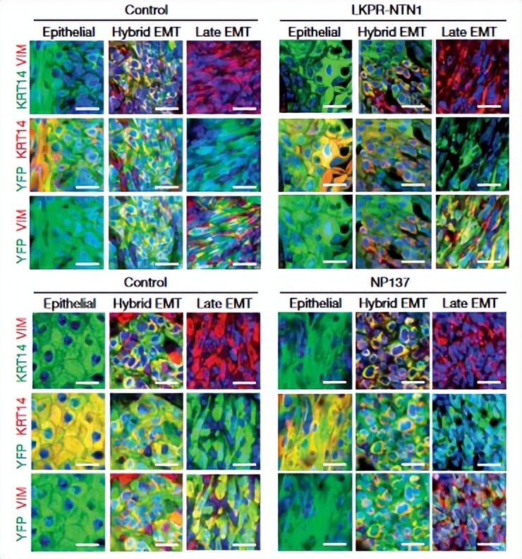 最早抗肿瘤单克隆抗体,单克隆抗体治疗效果