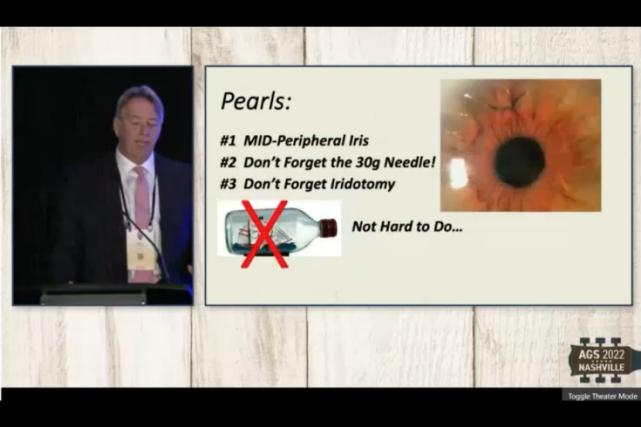 治疗囊袋内IOL脱位的新策略——简化的巩膜外固定术丨AGS2022