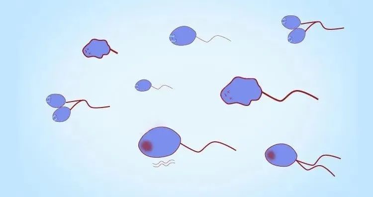 死精症是不是没得治,中医对于死精症的认识