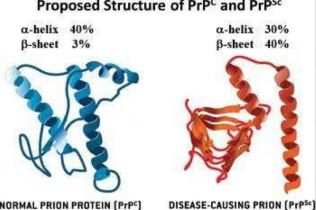 致死率100%！无药可救烹煮杀不死的朊病毒，感染后会有多恐怖？
