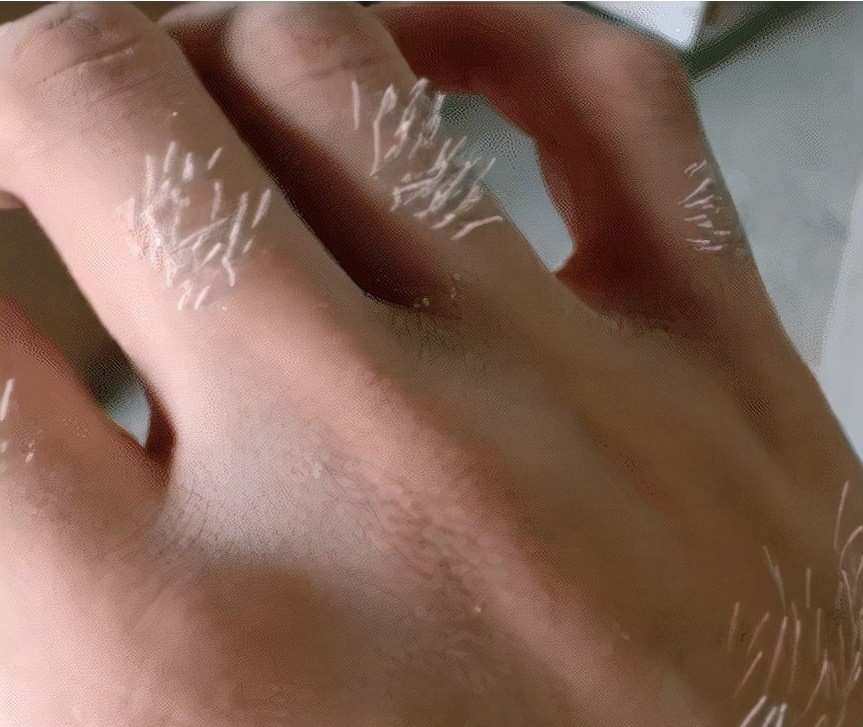 我才25岁，手上就长出来这么多白毛，这到底是怎么回事啊？