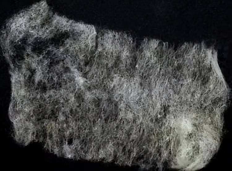 针灸医案董氏,针灸验案汇编